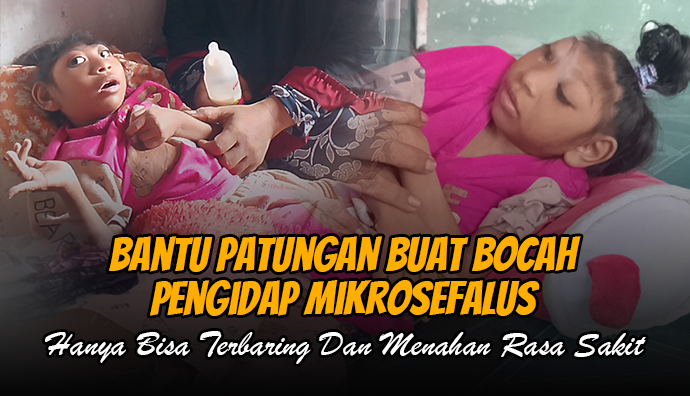 Bantu Ayah Kuli Bangunan Ini Berjuang Hidupi Anak Idap Mikrosefalus