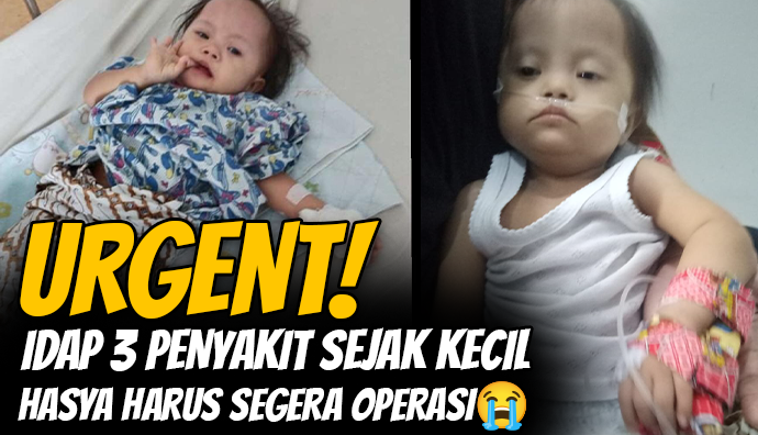 Idap 3 Penyakit Sekaligus, Bantu Anak 2 Tahun Penjual Kue Lakukan Pengobatan