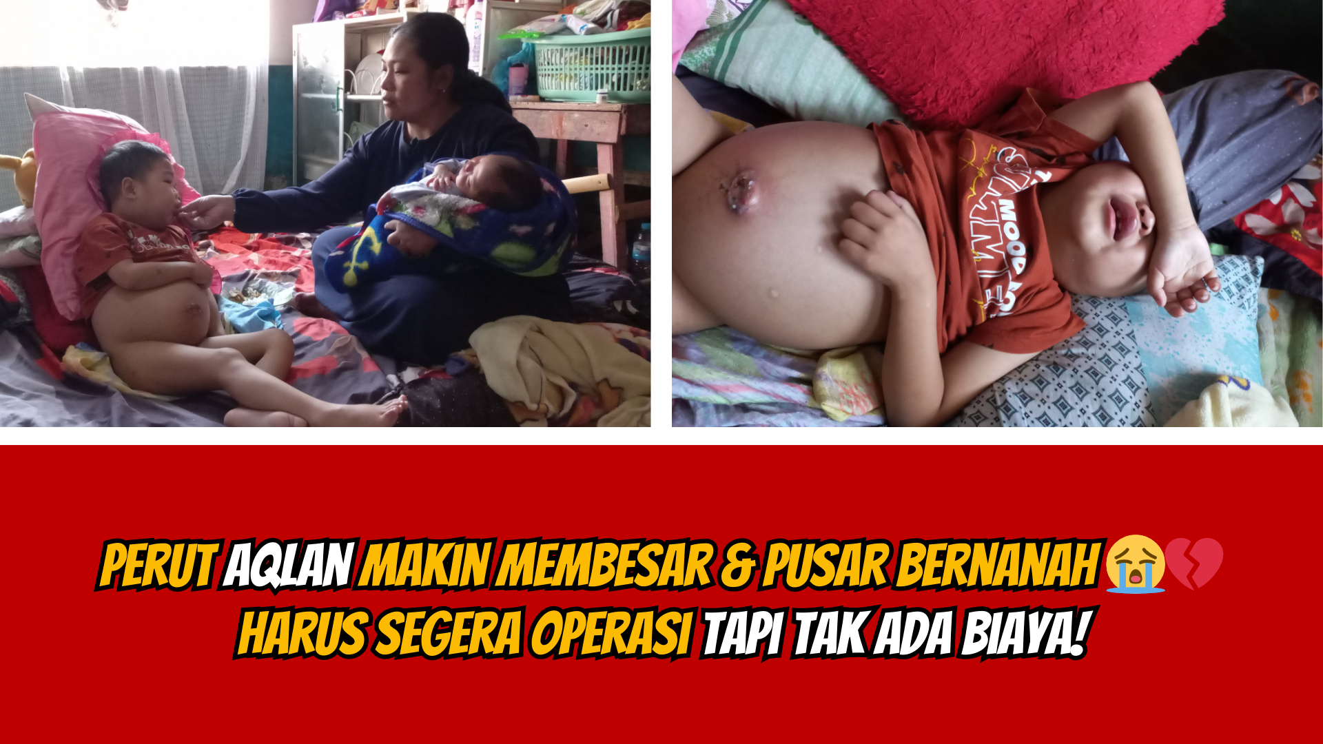 Idap Sindrom Nefrotik Tubuh Aqlan Semakin Membengkak !
