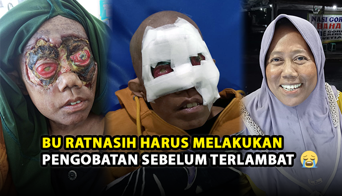 Tolong! Bantu Bu Ratnasih Butuh Pengobatan Segera
